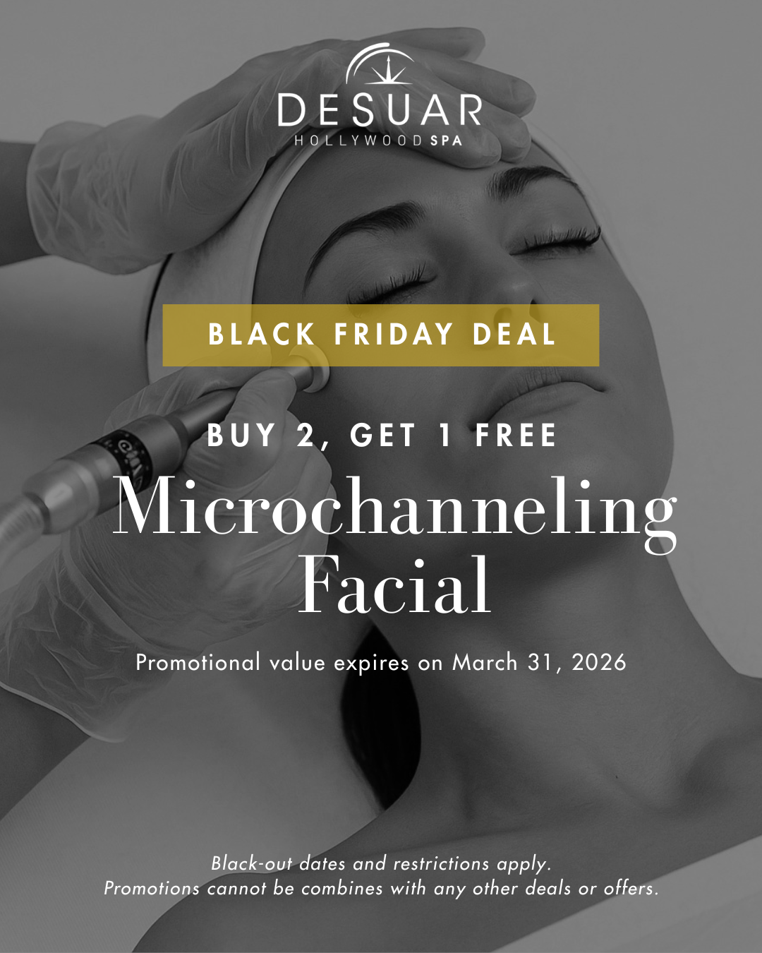 Microchanneling Facial - Buy 2, Get 1 Free